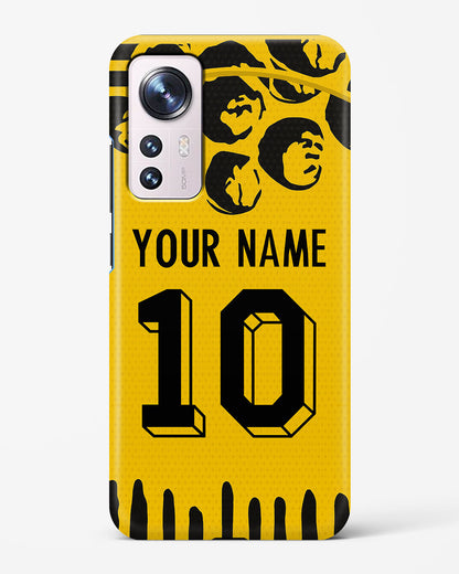 Dortmund Home 25/26 soccer jersey style hard phone case